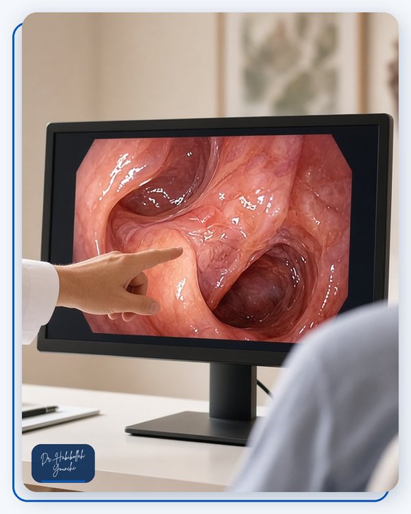 Treatment Options for Early Lesions Treatment Options for Early Lesions