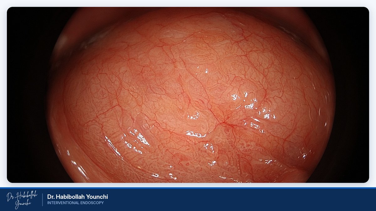 Advanced Endoscopic Techniques Advanced Endoscopic Techniques